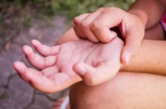 Що допомагає зменшити свербіж після укусу комахи